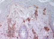 Purified freeze-dried antibody to bovine type IV collagen
