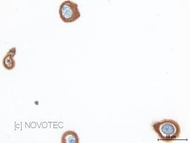 Chondrocyte in agarose gel _ Immunostaining of aggrecan