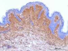 Purified freeze-dried antibody to human type I collagen