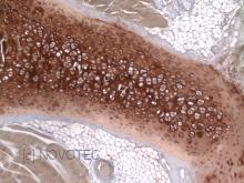 Purified freeze-dried antibody to rat type II collagen