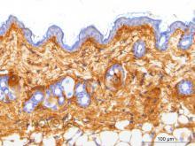 Purified freeze-dried antibody to mouse type III collagen