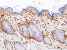 Purified freeze-dried antibody to mouse elastin
