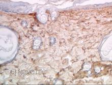 Purified freeze-dried antibody to rat type I collagen