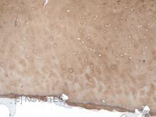Purified freeze-dried antibody to human type II collagen