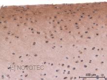 Purified freeze-dried antibody to bovine type II collagen