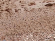 Purified freeze-dried antibody to chicken type II collagen