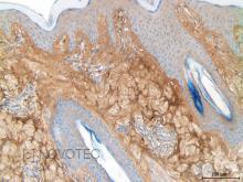 Purified freeze-dried antibody to bovine type III collagen