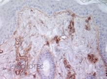 Purified freeze-dried antibody to bovine type IV collagen
