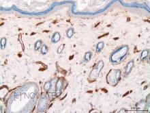 Purified freeze-dried antibody to rat type IV collagen