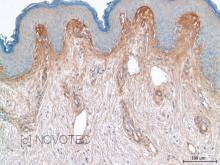 Purified freeze-dried antibody to human type V collagen