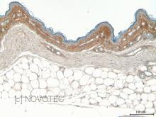 Purified freeze-dried antibody to chicken type V collagen