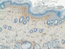 Purified freeze-dried antibody to rat type V collagen