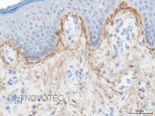 Purified freeze-dried antibody to human elastin