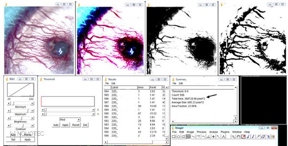 Quantitative analysis of eye vascularization