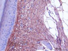 Purified freeze-dried antibody to chicken type I collagen