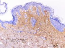 purified freeze-dried antibody to human type I collagen