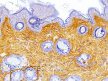 Purified freeze-dried antibody to mouse type I collagen