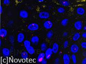 Mise en évidence par RNAscope d'une cytokine (Rose) exprimée dans un épiderme reconstruit Mise en évidence par RNAscope d'une cytokine (Rose) exprimée dans un épiderme reconstruit