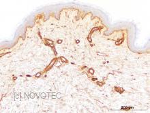 Purified freeze-dried antibody to human laminin