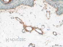 Purified freeze-dried antibody to endostatin 