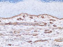 Purified freeze-dried antibody to human type IV collagen
