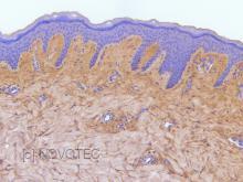 Purified freeze-dried antibody to human type I collagen