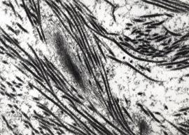 Collagen fibers