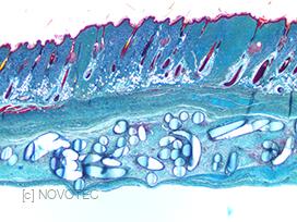 Biocompatibility study of chitosan filler (MTG).