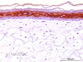 Marquage de la cytokeratine 10 dans une peau reconstruite