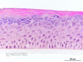 Reconstruct human epidermis (RHE) - HES staining.