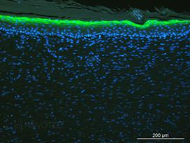 Localization of loricrin during the wound healing (IF on paraffin section).