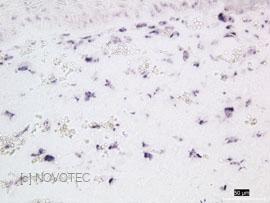 Expression du gene col1a1 par les fibroblastes.