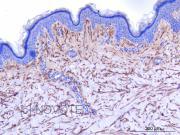 Purified freeze-dried antibody to human elastin