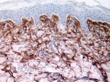 Purified freeze-dried antibody to porcine type I collagen