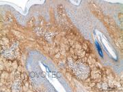 Purified freeze-dried antibody to bovine type III collagen