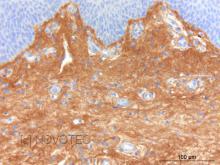 Purified freeze-dried antibody to human type III collagen